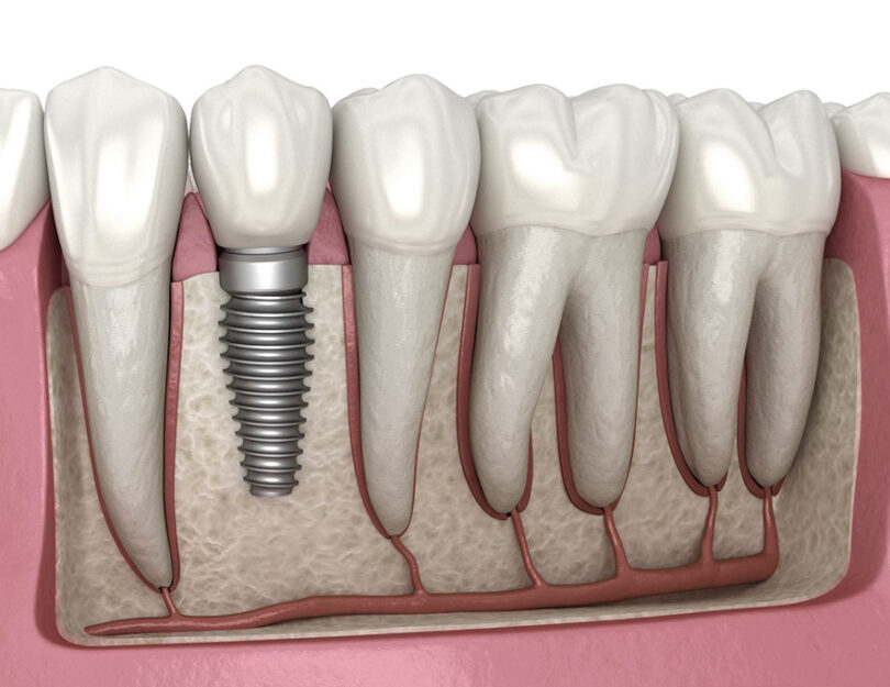 blog - Corner House Dental
